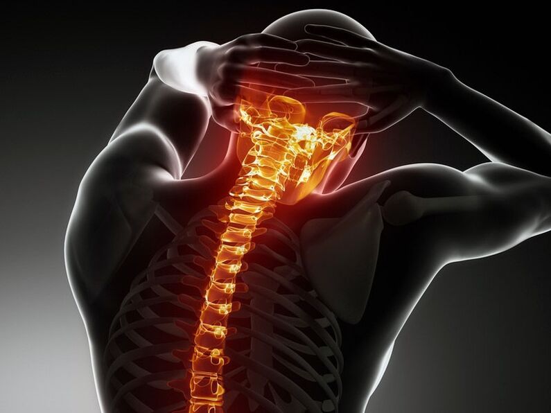 Osteochondrozės simptomai