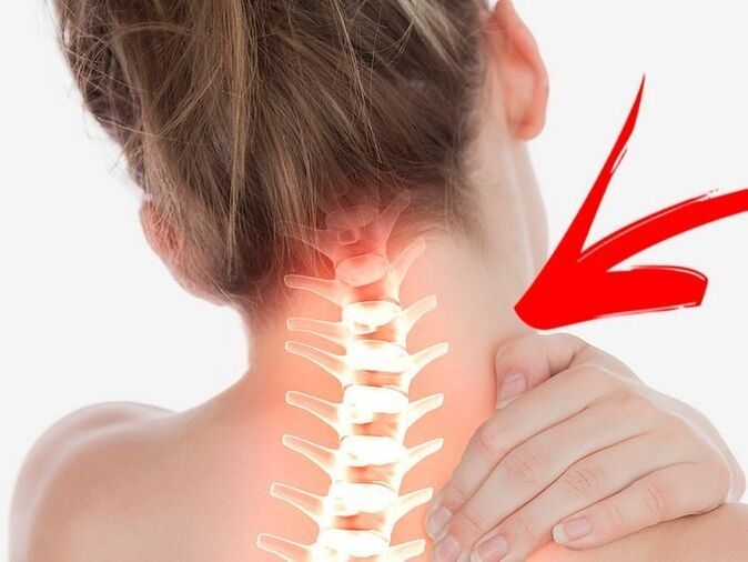 Nervų šaknų suspaudimas su gimdos kaklelio osteochondroze