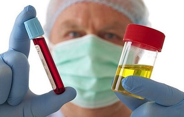 Gimdos kaklelio stuburo osteochondrozės diagnozavimo būdai