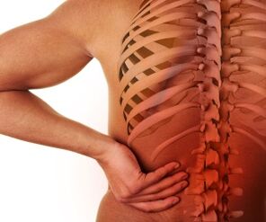 nugaros skausmas su juosmens osteochondroze